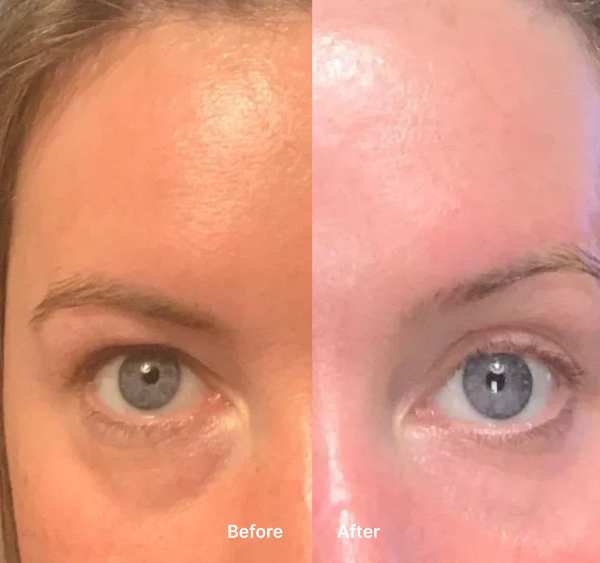 Soothing Remover Eye Bags Eye Massager